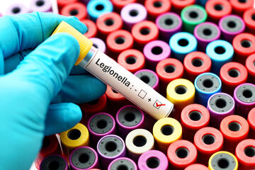 Legionella baktérium tudnivalók